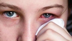 علل و علائم عفونت چشم چیست