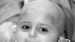 همدستی خدمات درمانی ناعادلانه وسرطان  درگرفتن زندگی کودکان
