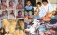 خودنمایی زخم های کهنه بر تن و جان مصدومان شیمیایی سردشت