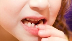اهمیت دندان شیری و تاثیر آنها روی دندان های دائمی چیست
